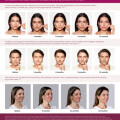 Galderma Launches Sculptra® in China, Further Fueling Its Growth Into One of the Fastest Growing Aesthetics Markets